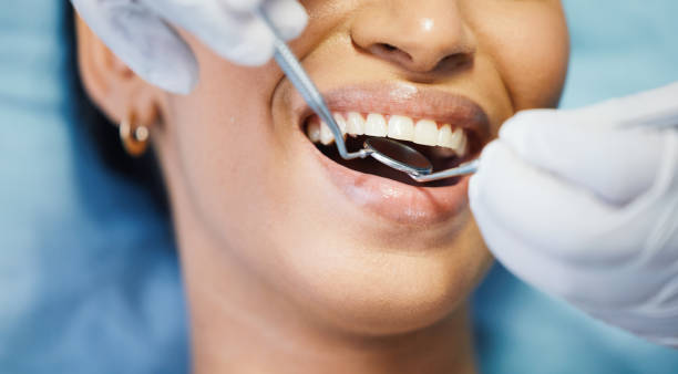 Our Range of Dental Services in Youngstown, NY